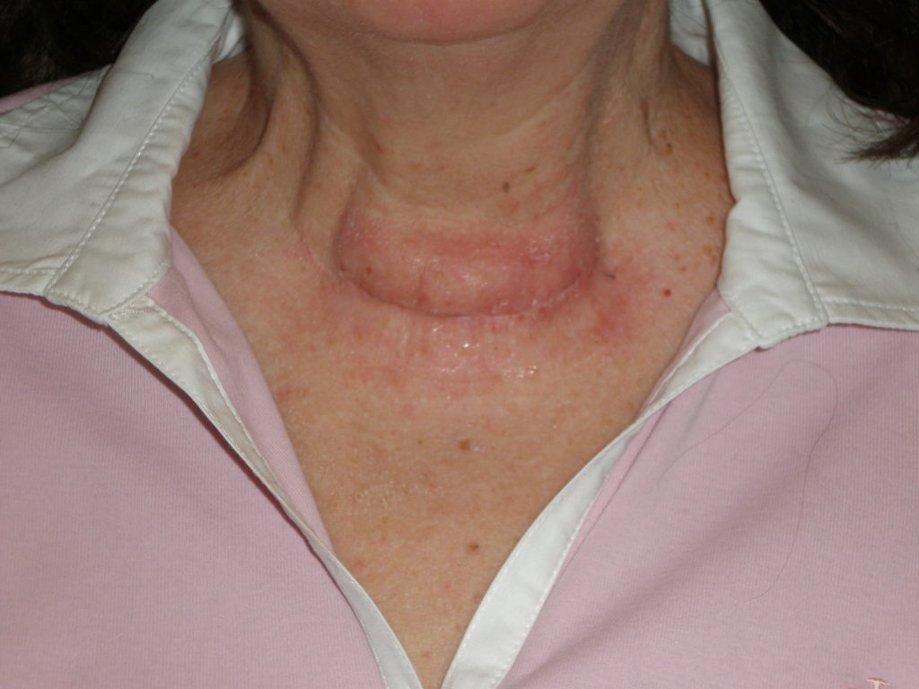 OLYMPUS DIGITAL CAMERA Atlanta's Advanced Thyroid and Parathyroid Center